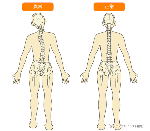 悪い姿勢